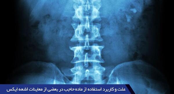 عکس رنگی کلیه نی نی سایت