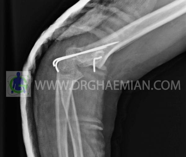 عکس رنگی کلیه نی نی سایت