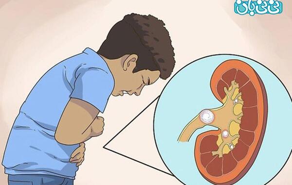 عکس رنگی کلیه نی نی سایت