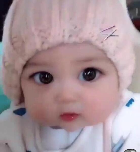 عکس رنگی vcug کودکان نی نی سایت