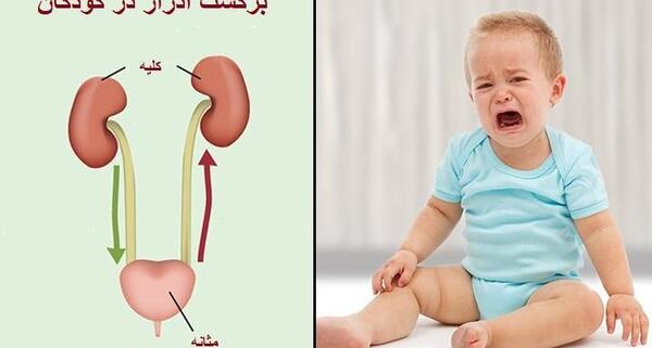 عکس رنگی vcug کودکان نی نی سایت