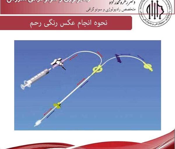 عکس رنگی رحم مشهد نی نی سایت