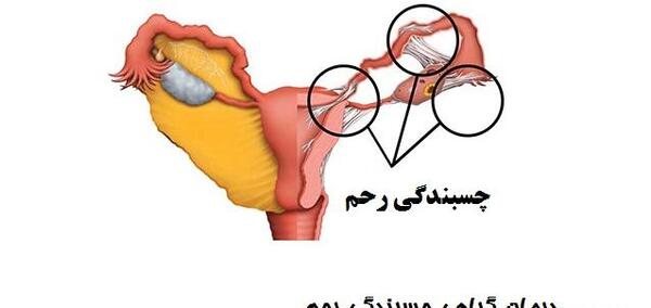 عکس رنگی رحم مشهد نی نی سایت