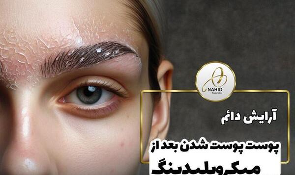 عکس فیبروز ابرو نی نی سایت