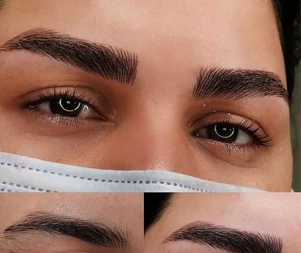 عکس فیبروز ابرو بعد از ترمیم نی نی سایت