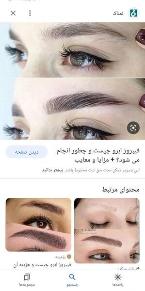 عکس فیبروز ابرو بعد از ترمیم نی نی سایت