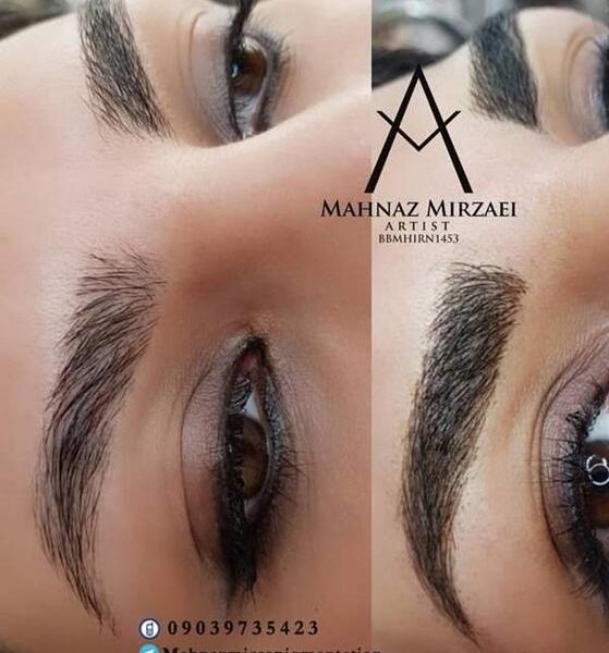 عکس فیبروز ابرو بعد از ترمیم نی نی سایت