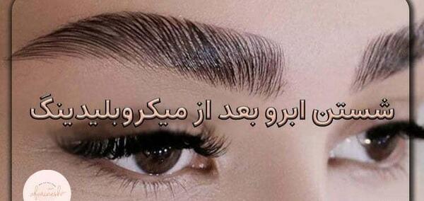 عکس فیبروز ابرو بعد از یک هفته نی نی سایت