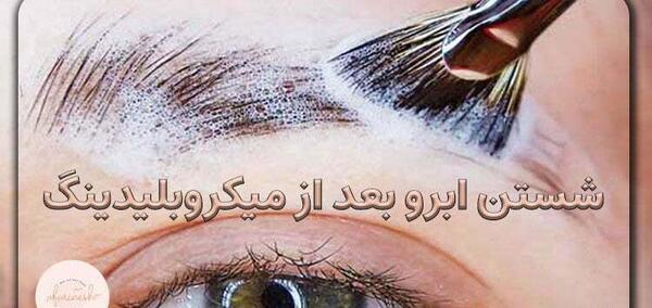 عکس فیبروز ابرو بعد از یک هفته نی نی سایت