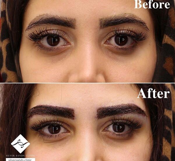 عکس سایه ابرو بعد از یک هفته نی نی سایت