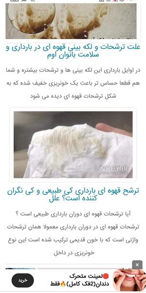 عکس ترشحات اوایل بارداری نی نی سایت
