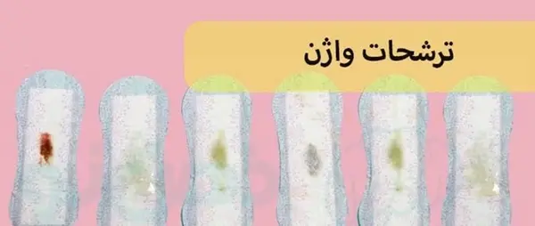 عکس ترشحات پنیری واژن در بارداری نی نی سایت