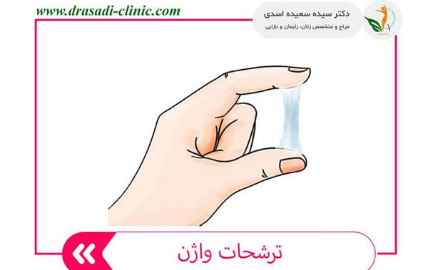 عکس ترشحات پنیری واژن در بارداری نی نی سایت