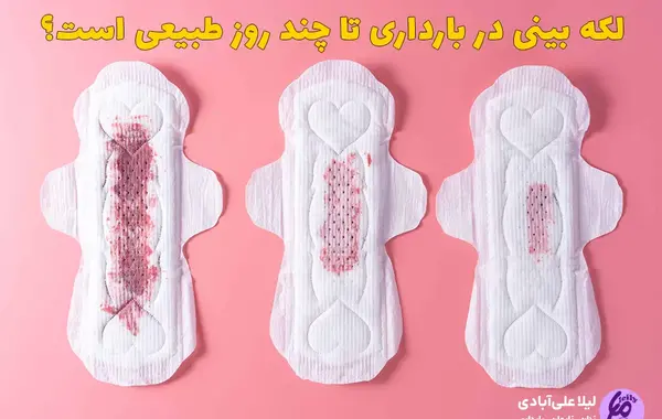عکس لکه بینی نی نی سایت