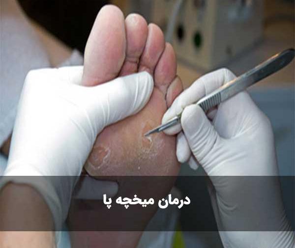 عکس ریشه میخچه پا نی نی سایت