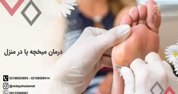 عکس ریشه میخچه پا نی نی سایت