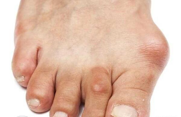 عکس قوزک پا نی نی سایت