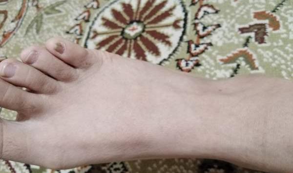 عکس قوزک پا نی نی سایت
