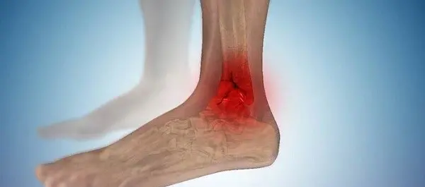 عکس مچ پا نی نی سایت
