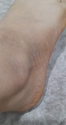 عکس مچ پا نی نی سایت