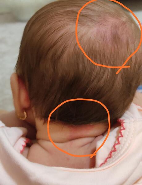 عکس نوزاد از پشت سر