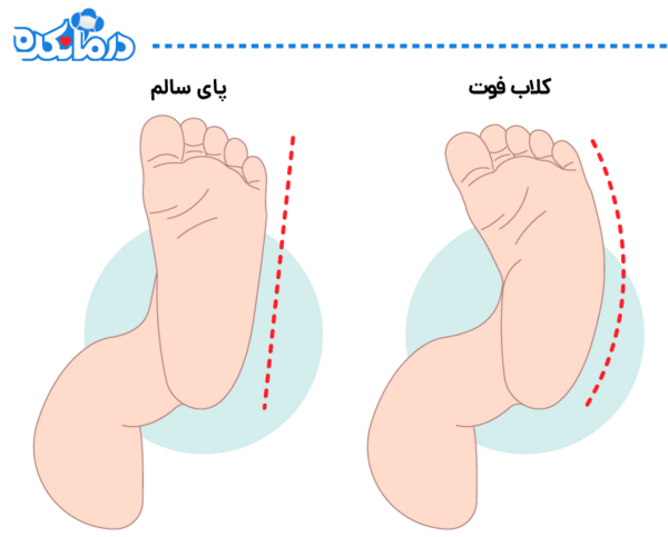 عکس نوشته نوزاد فوت شده