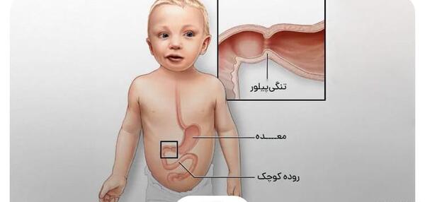 عکس بچه نوزاد مریض