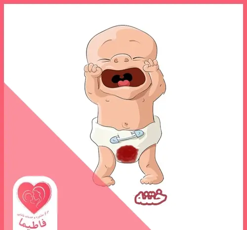 عکس روز اول ختنه نوزاد
