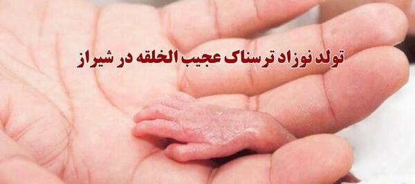 عکس نوزاد ترسناک ایرانی