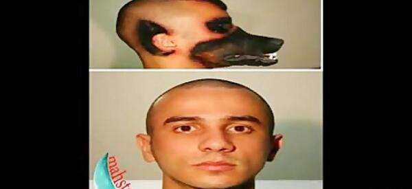 عکس عمل های زیبایی وحشتناک