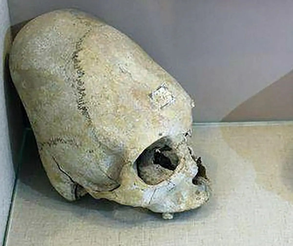 عکس جمجمه وحشتناک