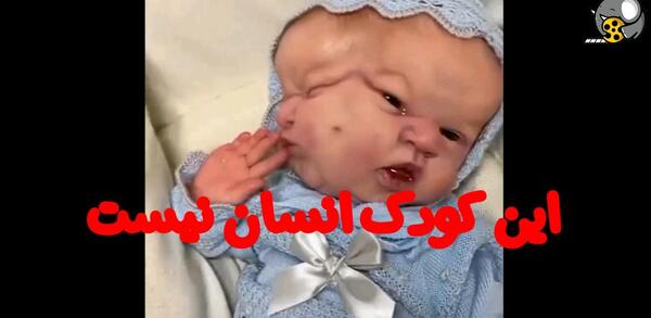 عکس وحشتناک ترین بچه