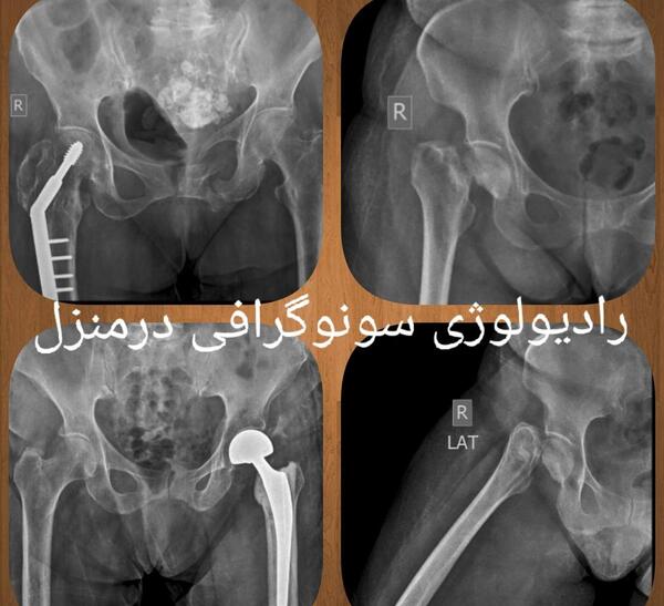 بهترین مرکز عکس رنگی رحم در مشهد