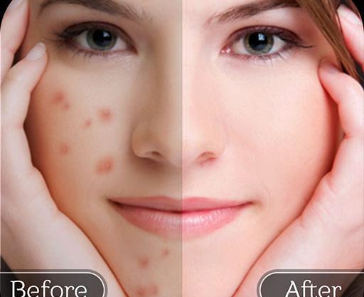 بهترین برنامه ویرایش عکس چهره برای ایفون