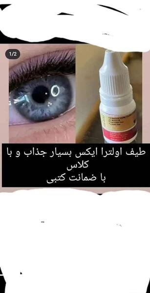 عکس oct چشم نی نی سایت
