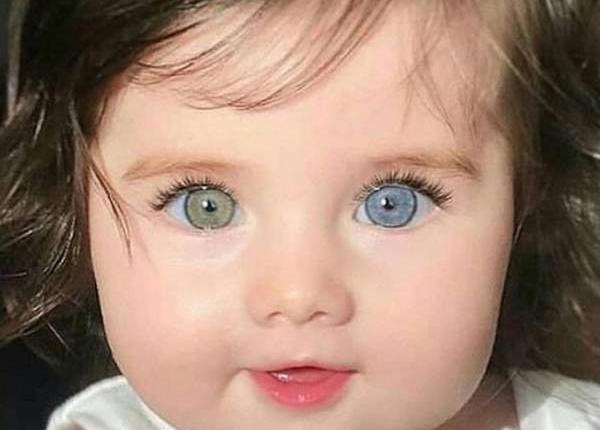 عکس oct چشم نی نی سایت