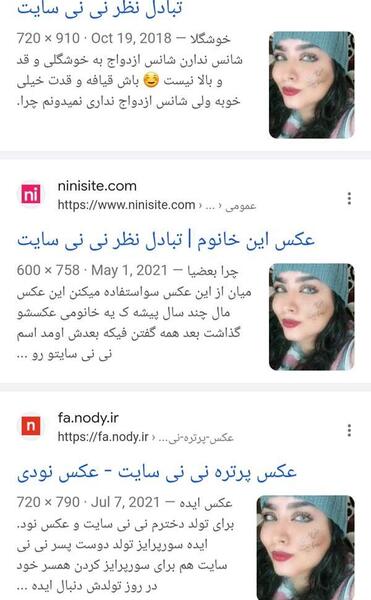 عکس oct چشم نی نی سایت