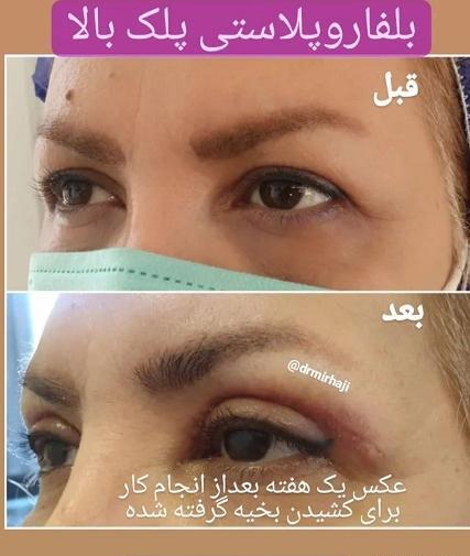 هزینه عکس چشم نی نی سایت