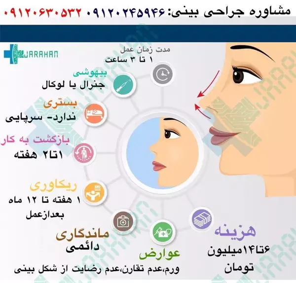 هزینه عکس چشم نی نی سایت