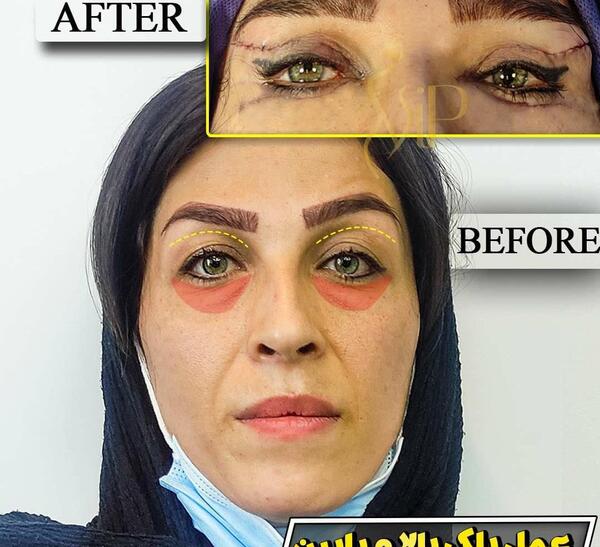 هزینه عکس چشم نی نی سایت