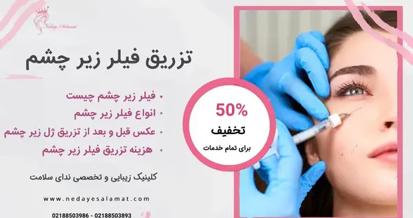 هزینه عکس چشم نی نی سایت