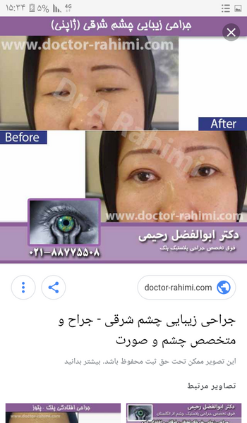 هزینه عکس چشم نی نی سایت