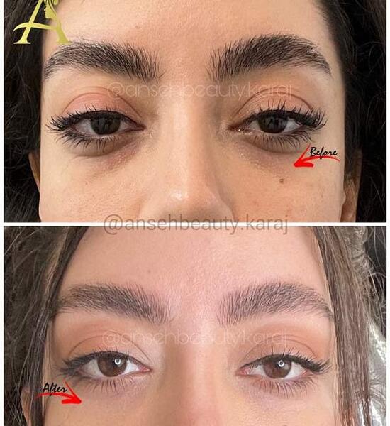هزینه عکس چشم نی نی سایت