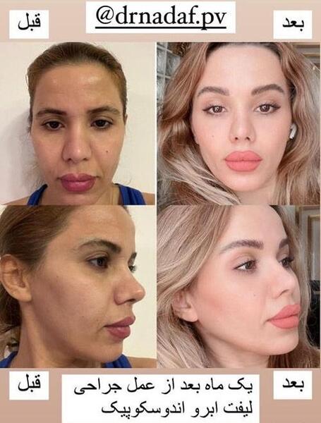 هزینه عکس چشم نی نی سایت