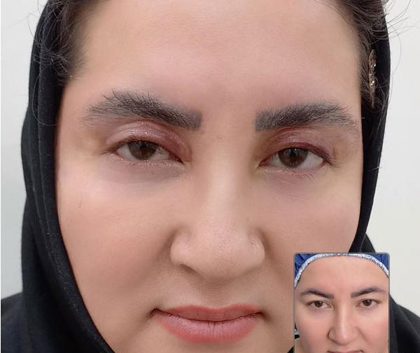 هزینه عکس چشم نی نی سایت