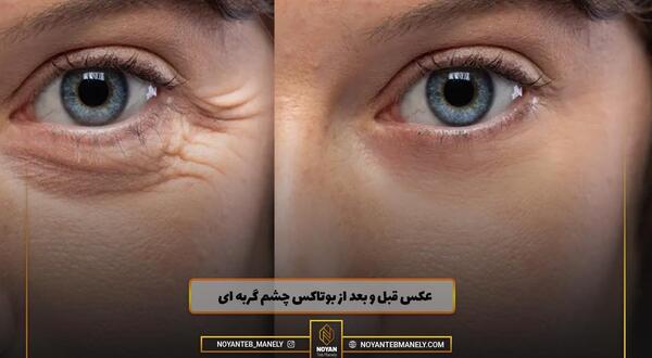 هزینه عکس چشم نی نی سایت