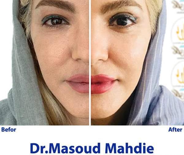 هزینه عکس چشم نی نی سایت