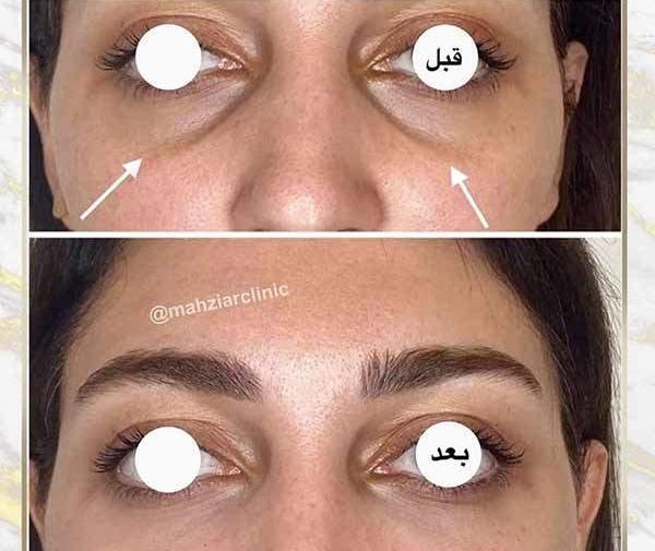 هزینه عکس چشم نی نی سایت