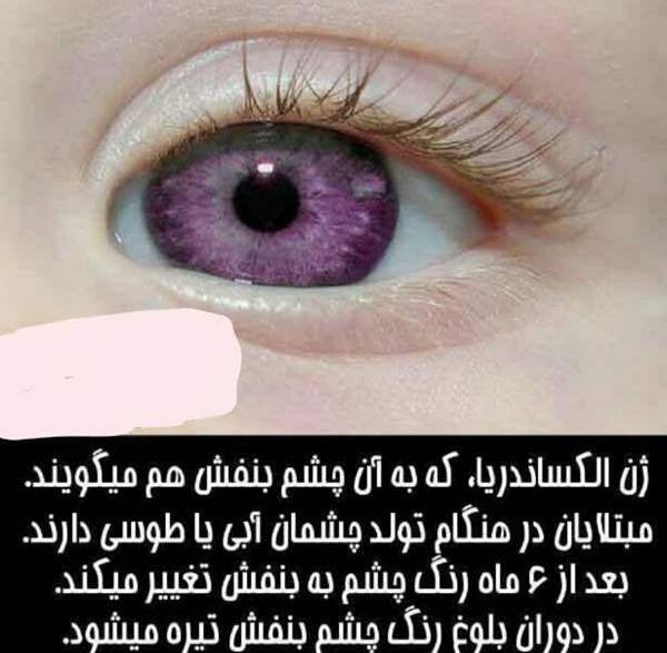 عکس چشم رنگی نی نی سایت