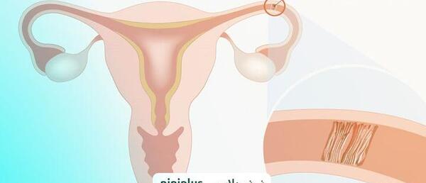 عکس رنگی بعد از حاملگی خارج از رحم نی نی سایت
